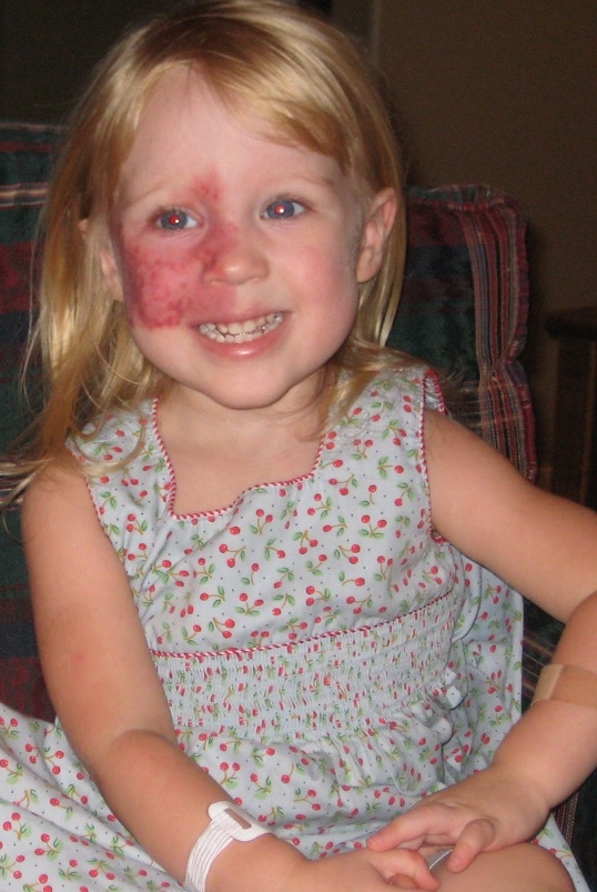 What Happened To Her Face? | Handling the questions with humor and grace.
