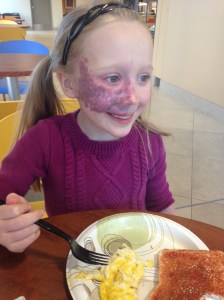 Having breakfast after Addy's latest laser treatment.