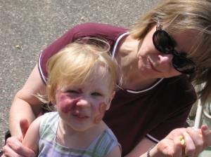 Addy Festival Port Wine Stain Toddler