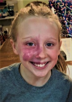 addy-pws-pushing-teeth-copy